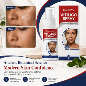BalanceVie Vitiligo Spray bottle with fine mist nozzle for facial and body application