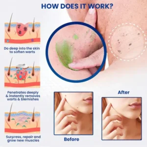 Elycura Instant Mole & Spot Cream compact 15ml airless pump bottle with outer carton