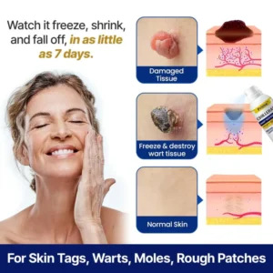 Prime ChillErase cooling skincare spray