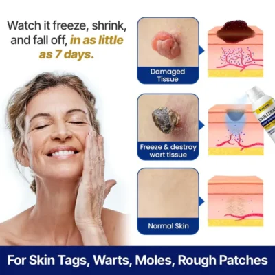 Prime ChillErase cooling skincare spray