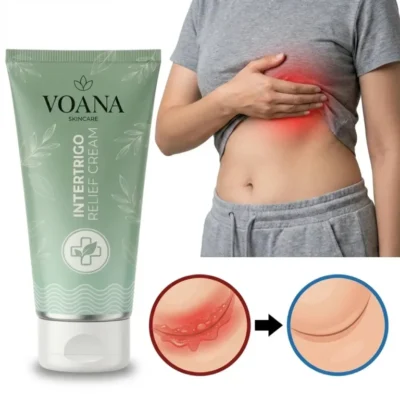 Voana Intertrigo Relief Cream