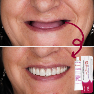 SecuraDent™ Thermoplastic Denture Adhesive with Vegetable Cellulose, Aloe Vera, and Chamomile