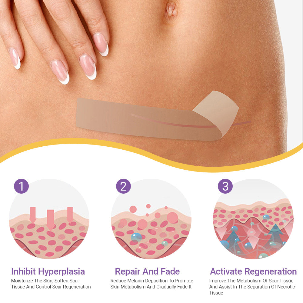 Luxevéria Microneedle Stretch Mark Patch