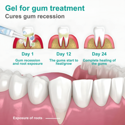 Qelunique botanical gum care gels