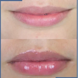 Luxevéria Lip Care Essence Oil with a gold cap