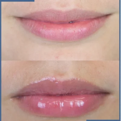 Luxevéria Lip Care Essence Oil with a gold cap
