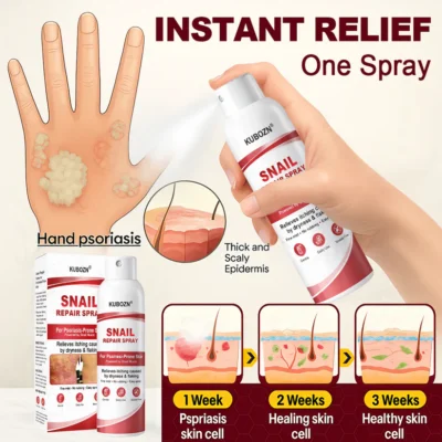 KUBOZN® Snail Repair Spray for Itchy, Flaky Psoriasis Skin bottle with fine mist nozzle