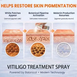 Sylovona Glow™ Vitiligo Treatment Spray featuring Piperine, Bakuchiol, and Ginkgo Biloba
