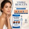 Luxevéria Mole Removal Roller Pen