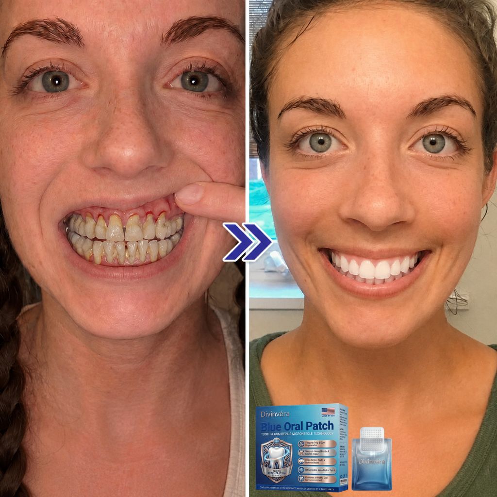 Divinvéra Blue Oral Patch
