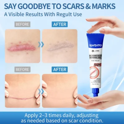 Alisanda silicone scar repair cream