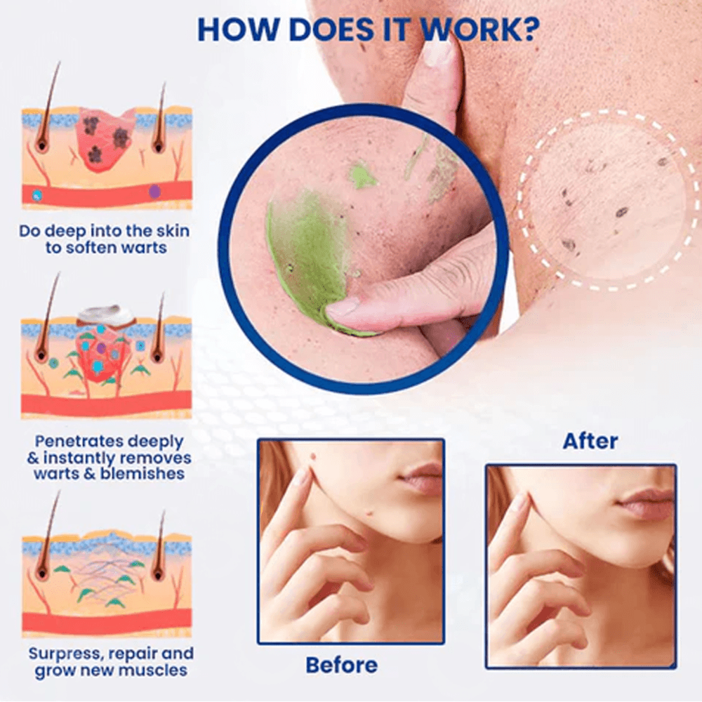 Luxevéria Mole Removal Cream