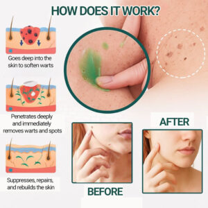 Luxevéria Spot Fading Gel used as part of an everyday skincare routine