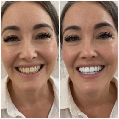Sylovona Glow Simply White Teeth Whitening Powder