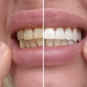 Sylovona Glow teeth whitening powder