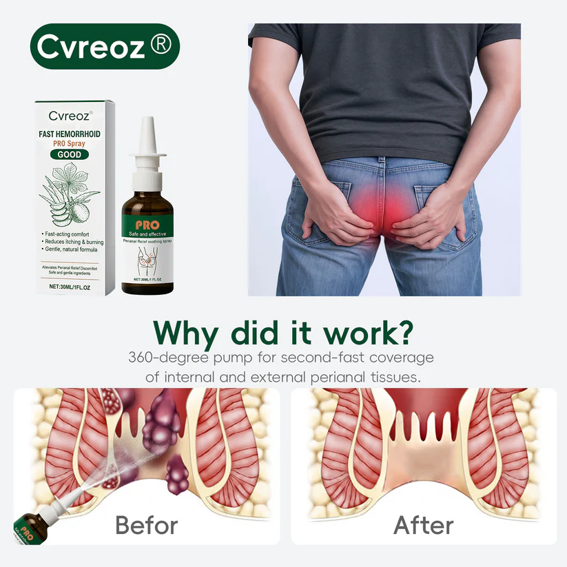Cvreoz® Fast Hemorrhoid PRO Spray for discreet daily body care