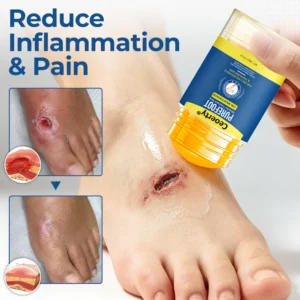 Ceoerty® foot care stick