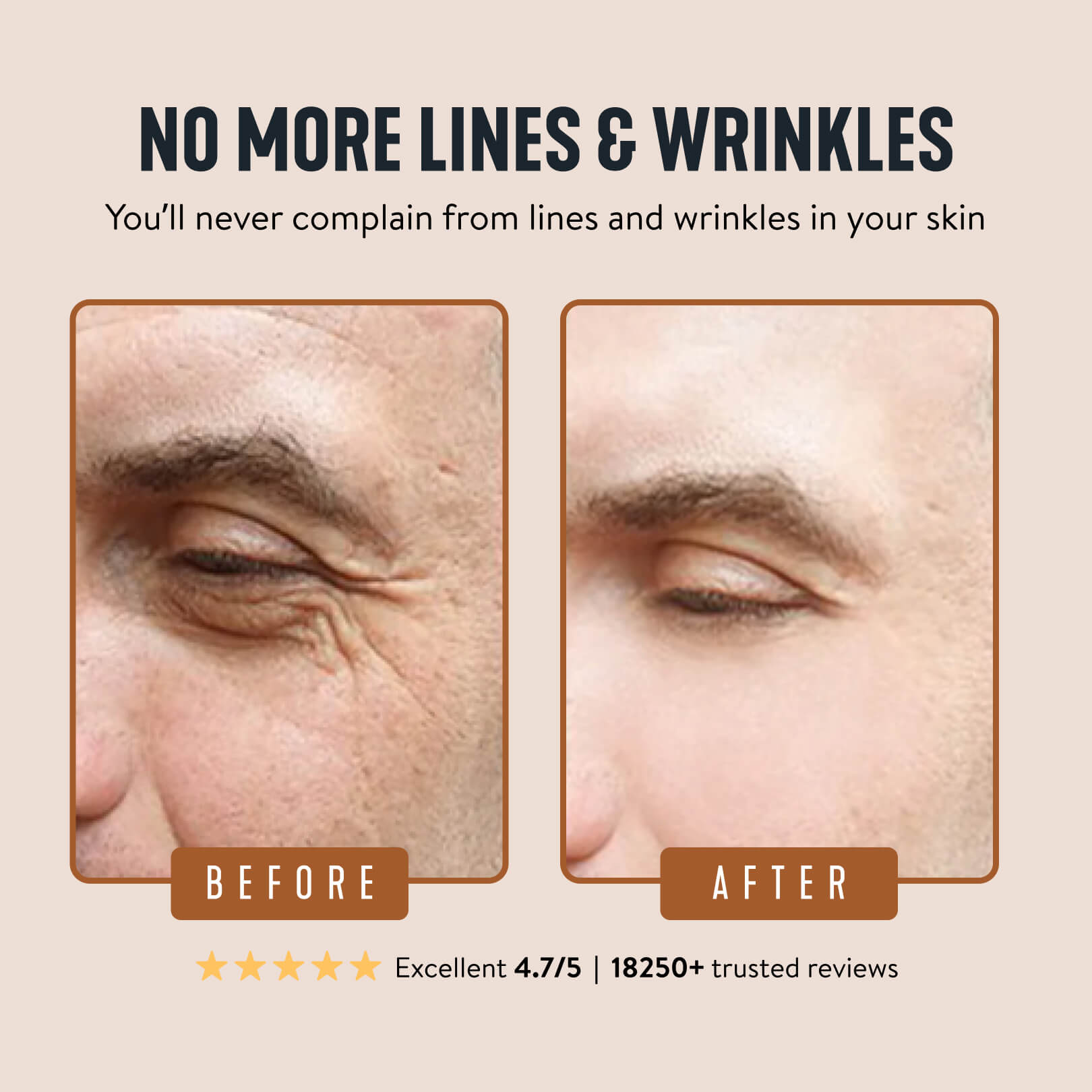 Tryskintle Wrinkle Defense Tallow Balm with tremella and hyaluronic acid