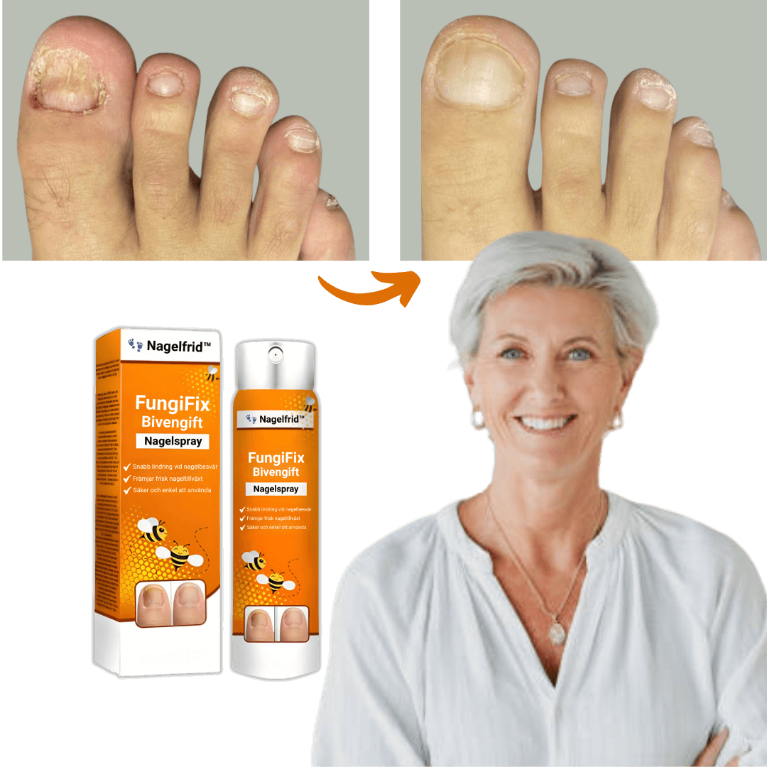 Nagelfrid™ FungiFix Nail Spray for daily nail care