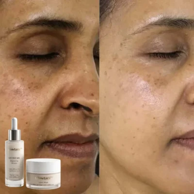 Glowtara™ Extreme Brightening Booster and Glow Mask Set with coffee oil