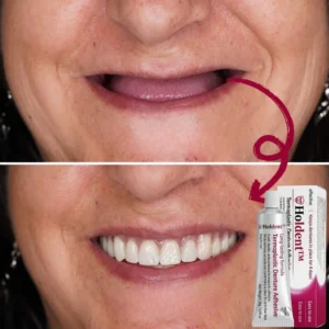 Holdent™ denture adhesive