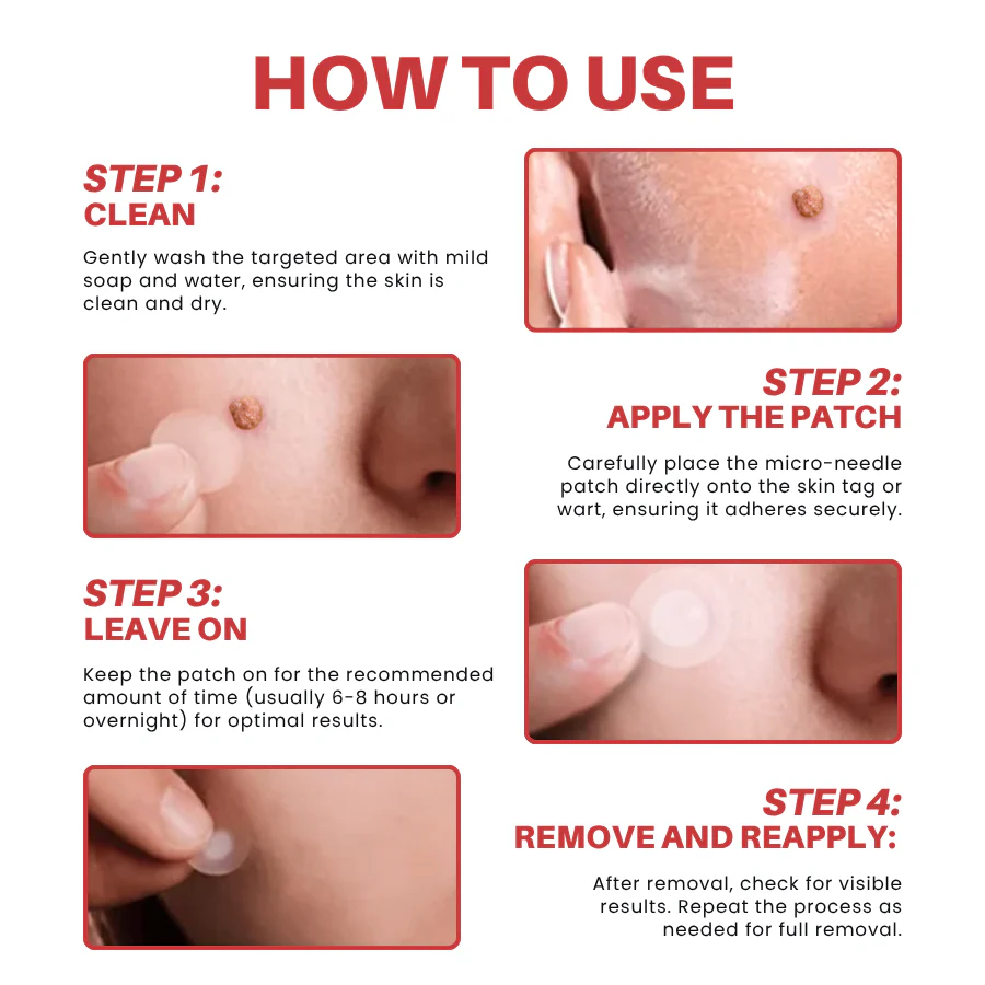 Fivfivgo® MicroNeedle Botanic Skin Tag Removal Patch