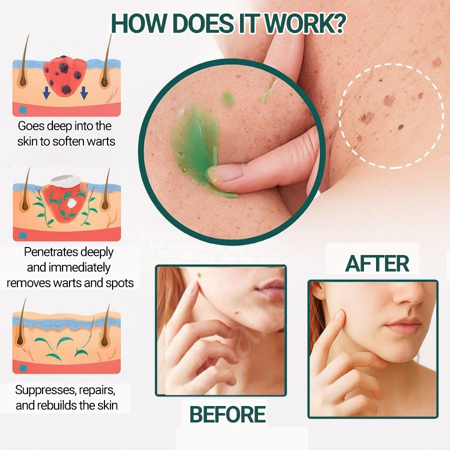 Elycura botanical skincare gel