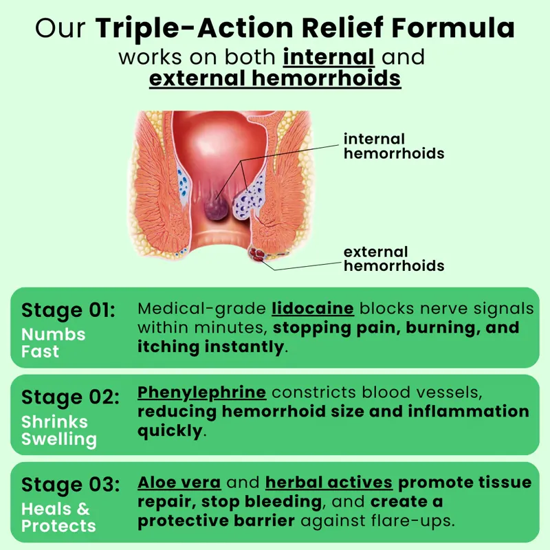 Nuvelliana™ Hemorrhoid Ointment