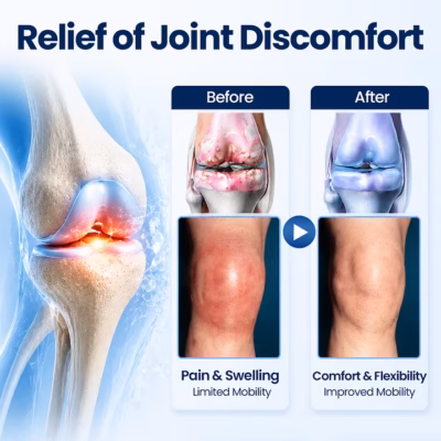 Timilk® topical joint recovery cream