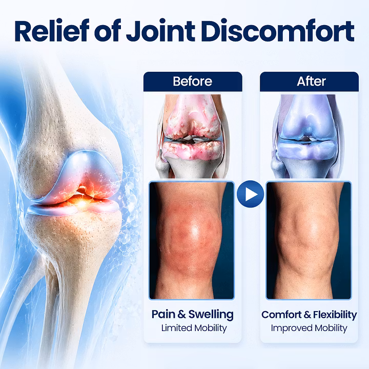 Timilk® topical joint recovery cream