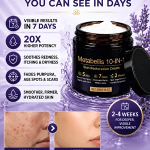Metabellis face and body cream
