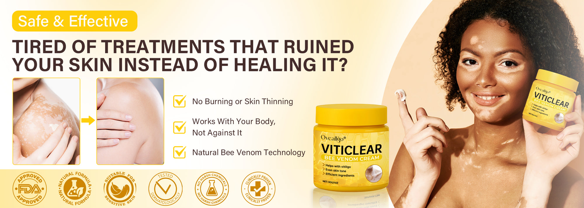 Oveallgo® non-steroidal bee venom cream