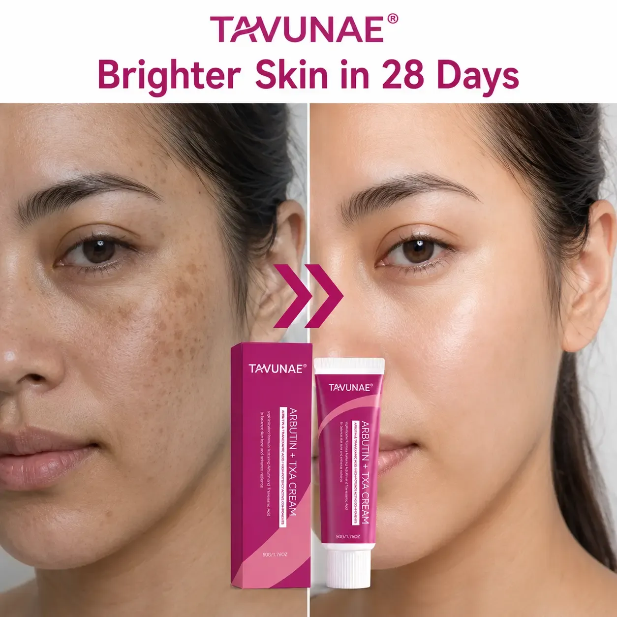 Tavunae® Arbutin + TXA Cream with Arbutin and Tranexamic Acid