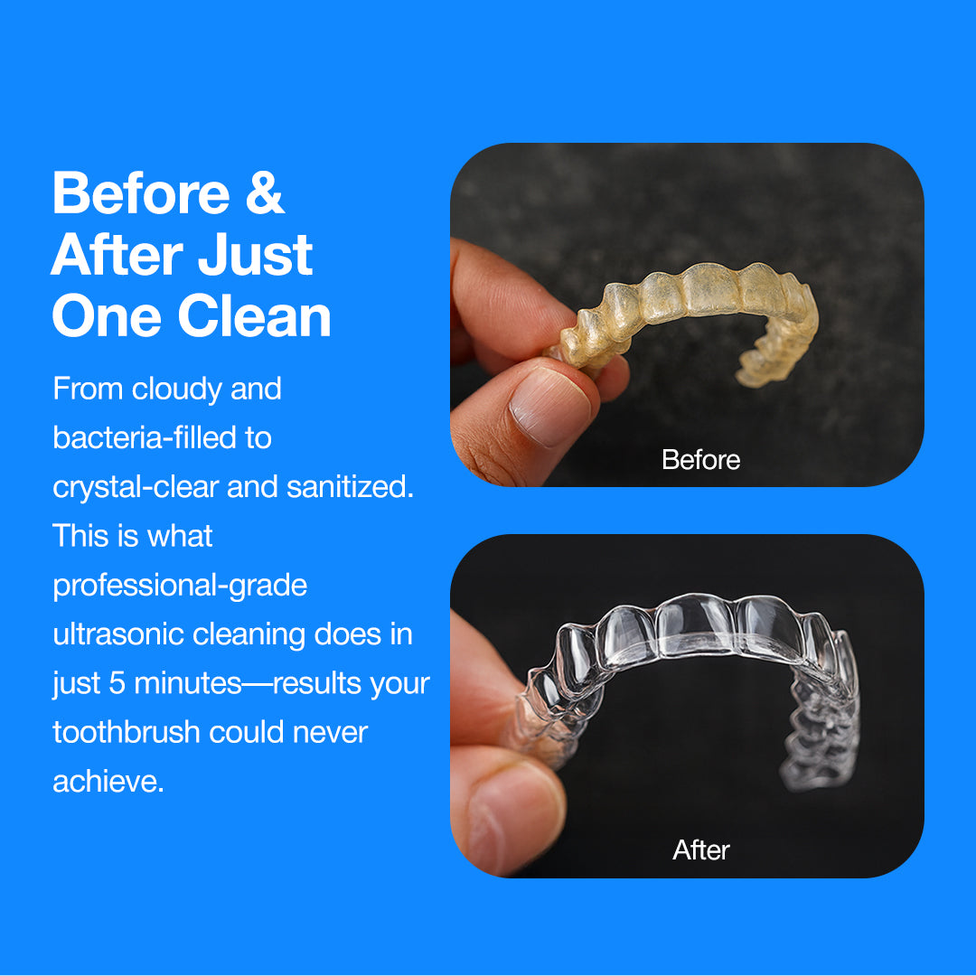 DentalPULSE Pod cleaner with ultrasonic sound wave technology