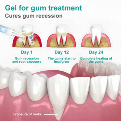 Elycura™ topical oral care gel