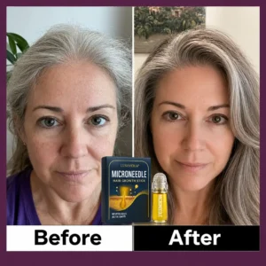 Luxevéria® Microneedle Hair Growth Stick with peptides and peppermint oil