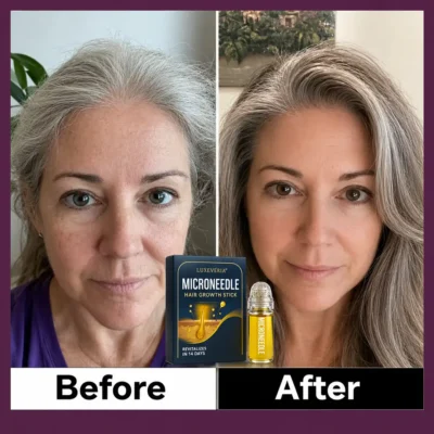 Luxevéria® Microneedle Hair Growth Stick with peptides and peppermint oil