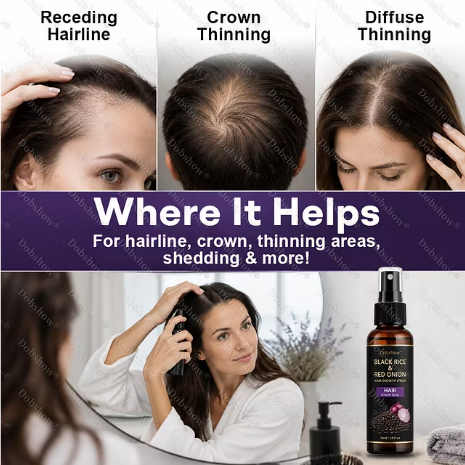 Dobshow® botanical scalp and root hair spray