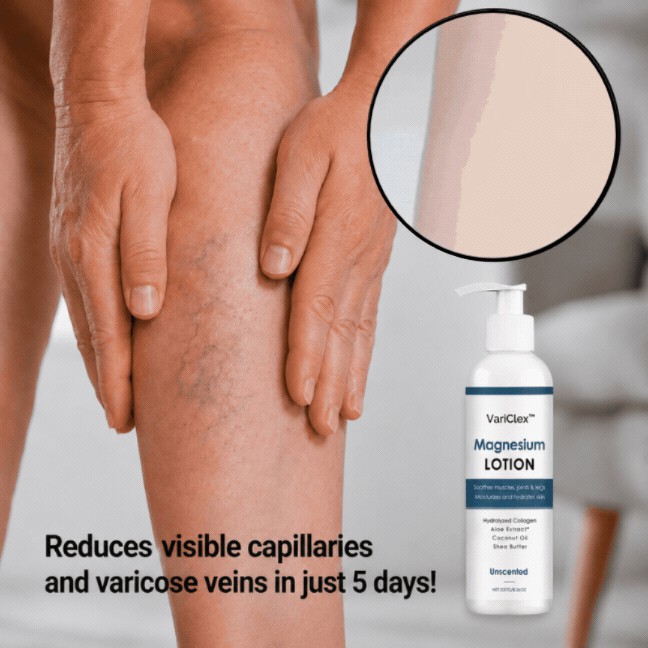 VariClex™ Leg Serum with horse chestnut extract
