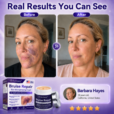 Rolimey® bruise repair cream for fragile skin