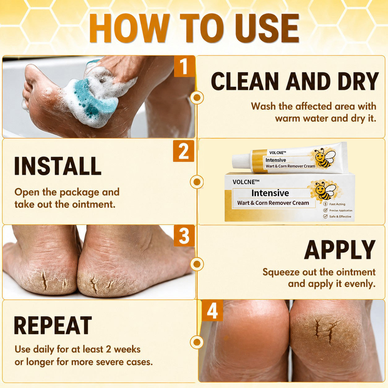 VOLCNE™ Intensive Wart & Corn Remover Cream