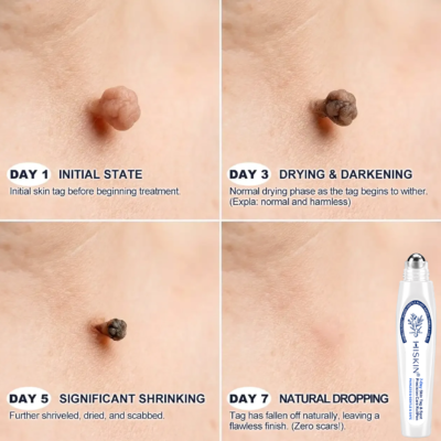 HISKIN® botanical rollerball skincare pen