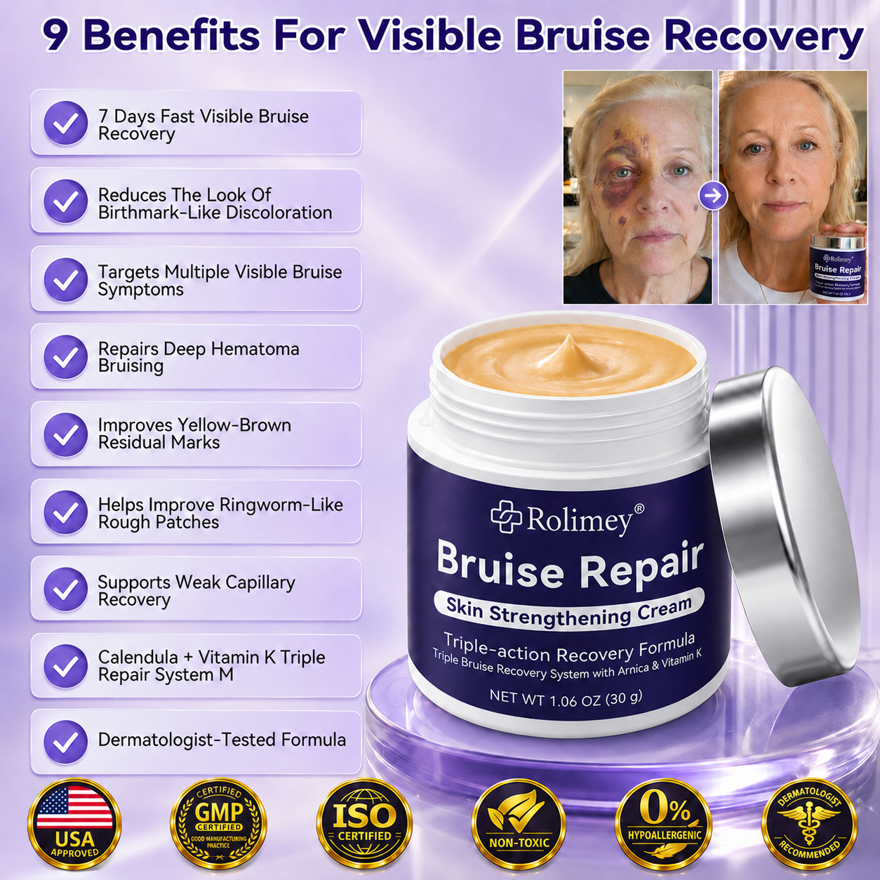 Rolimey® topical cream with calendula
