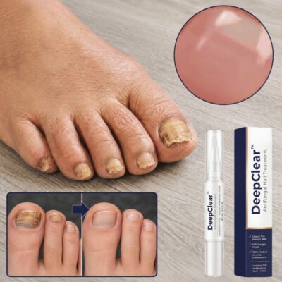 DeepClear Nail Treatment Pen