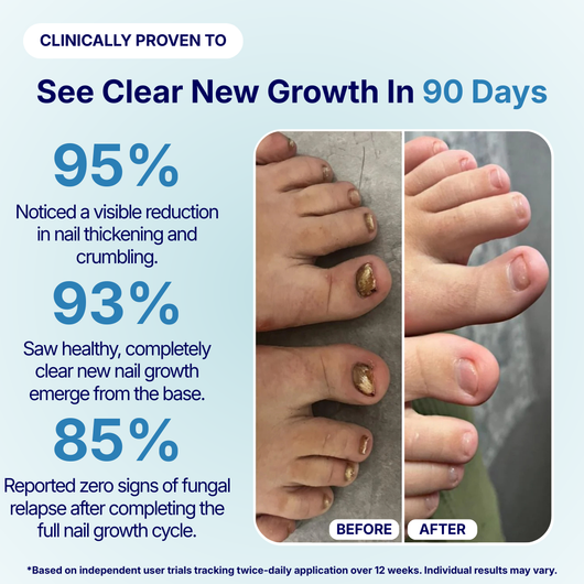 Dermatic™ nail treatment pen designed for targeted antifungal application