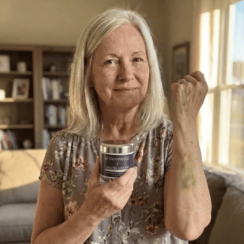 Dermevia™ crema con arnica per la cura dei lividi persistenti
