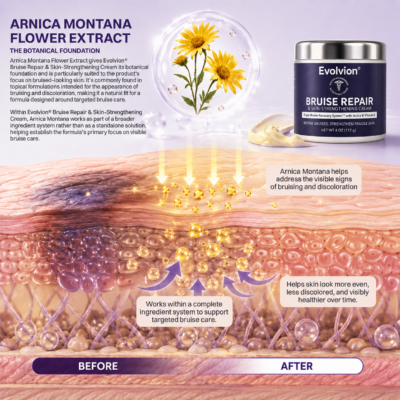 Evolvion topical skincare cream for arms, hands, and legs