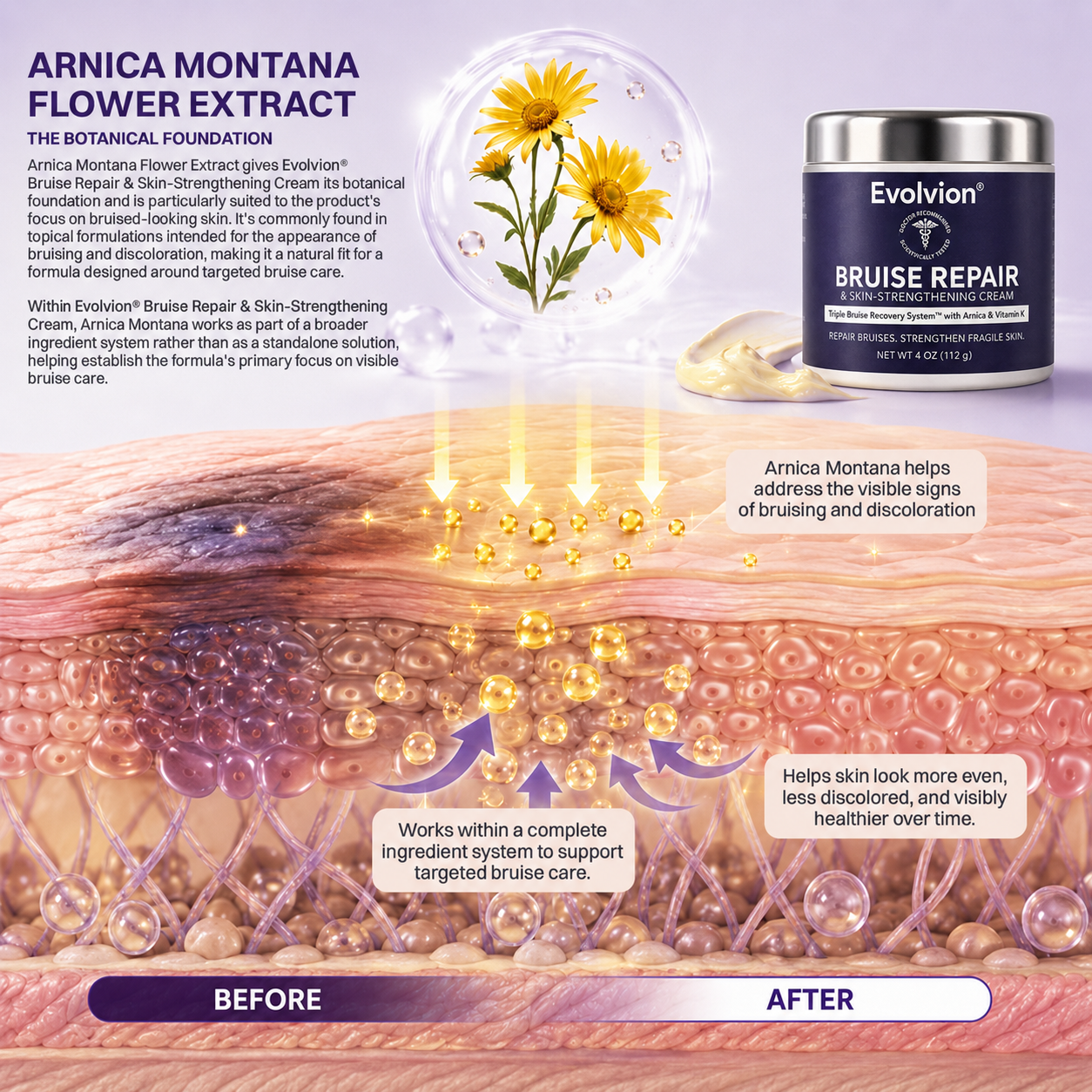 Evolvion topical skincare cream for arms, hands, and legs