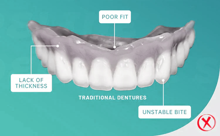 Beautylulus adhesive-free moldable dentures