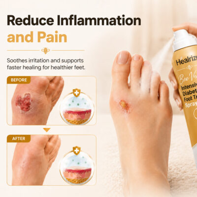 Healrize® Bee Venom Intensive Diabetic Foot Treatment Spray
